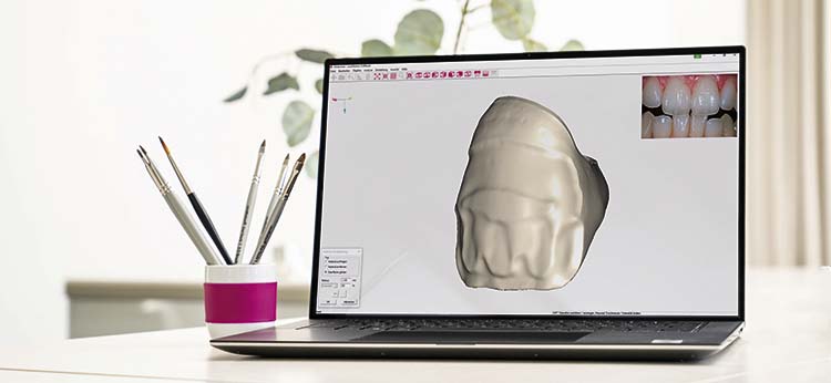 ceraMotion® CADback – die Kreativ-Software für Keramiker!