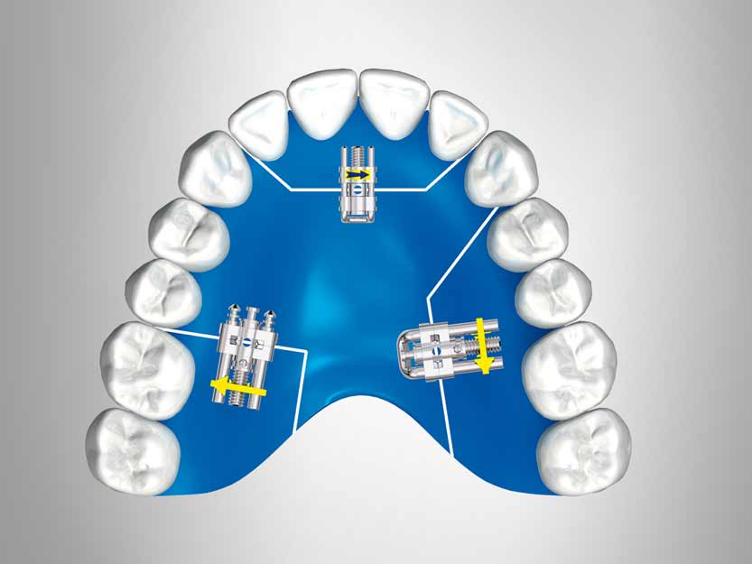 Servicio de productos de ortodoncia