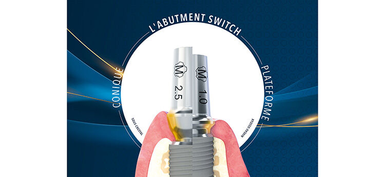 Dentaurum &eacute;largit la gamme num&eacute;rique d’implants tioLogic&reg; TWINFIT