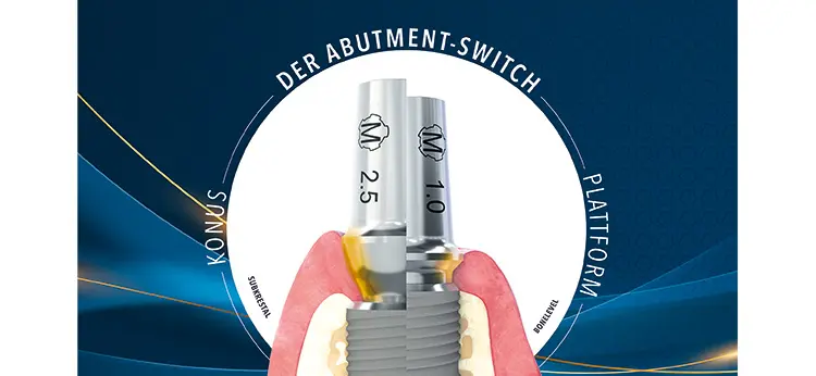 Dentaurum erweitert das digitale Implantat-Sortiment von tioLogic&reg; TWINFIT