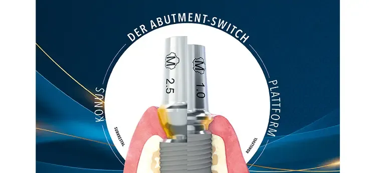 Dentaurum erweitert das digitale Implantat-Sortiment von tioLogic&reg; TWINFIT