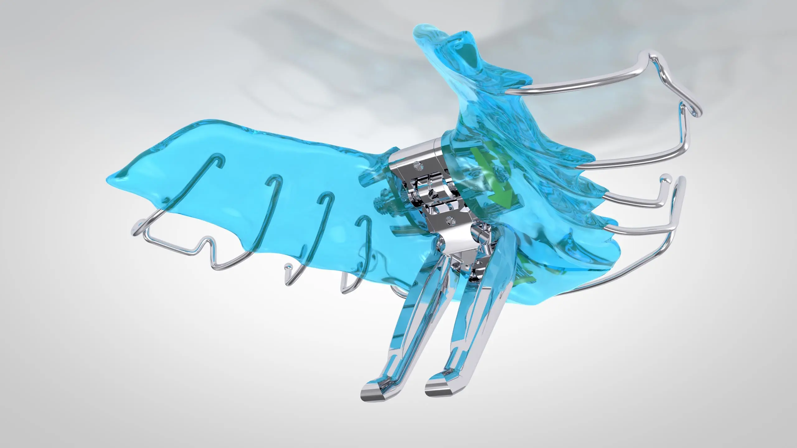 Effiziente Behandlung von Klasse II Fehlstellungen: