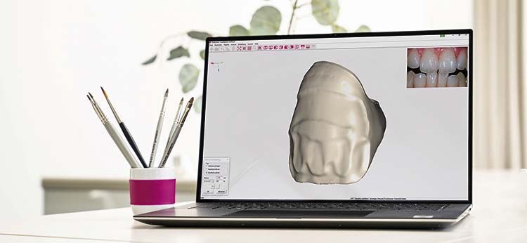 ceraMotion® CADback – the creative software for dental ceramists!