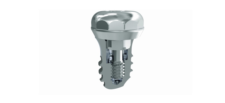 The palatal implant tomas® PI