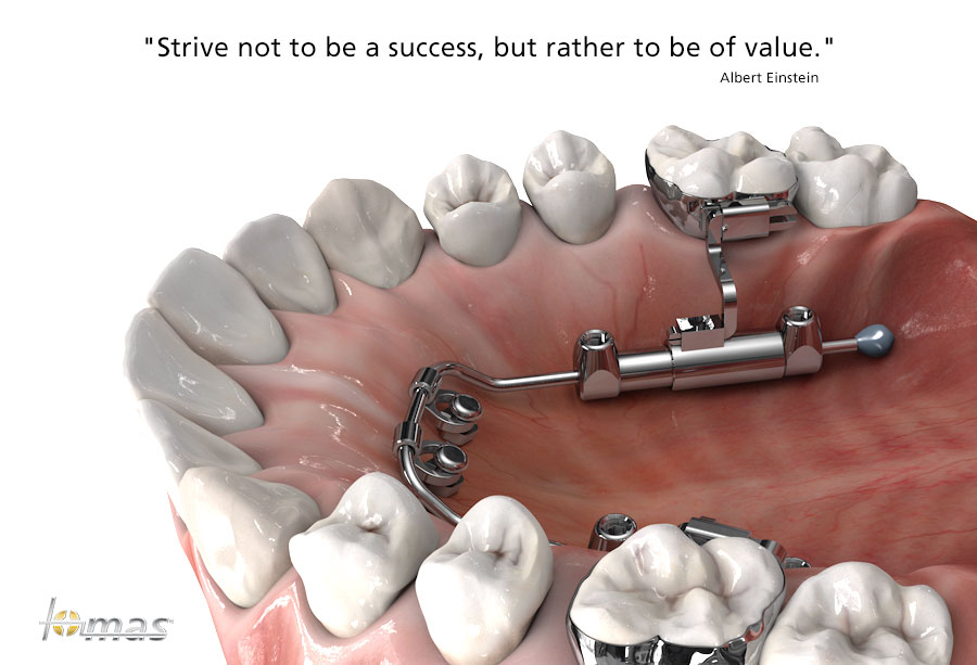 tomas temporary orthodontic micro anchorage system